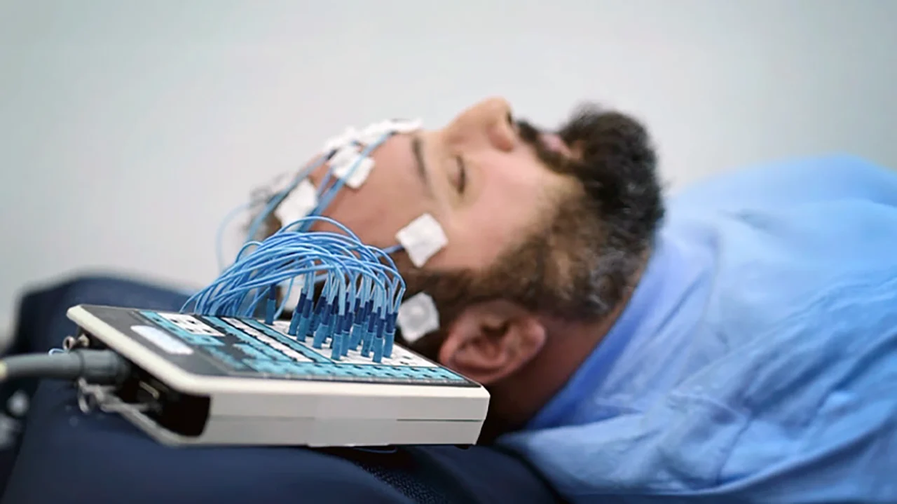 Epilepsia